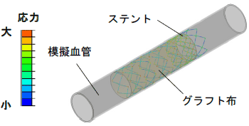 解析例図