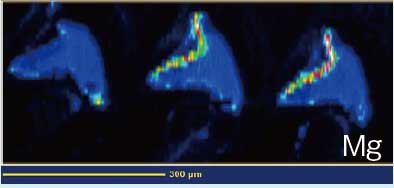 元素イメージング（Mg）